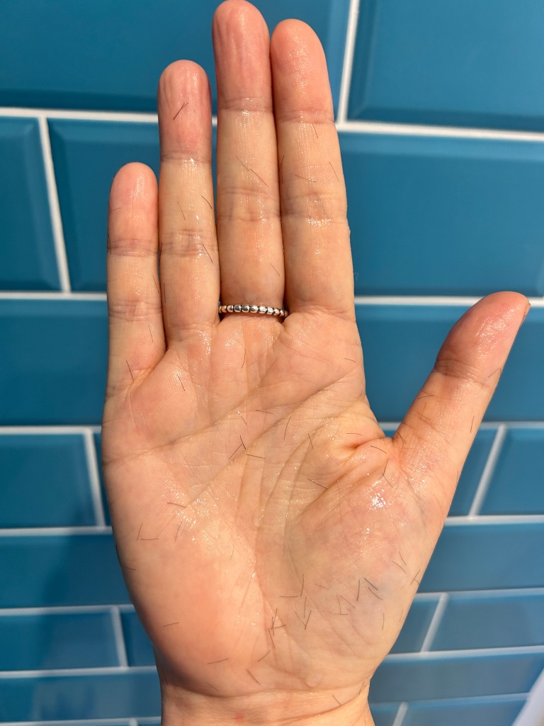 A white woman's palm with short dark hairs all over it from washing her hair after chemotherapy.